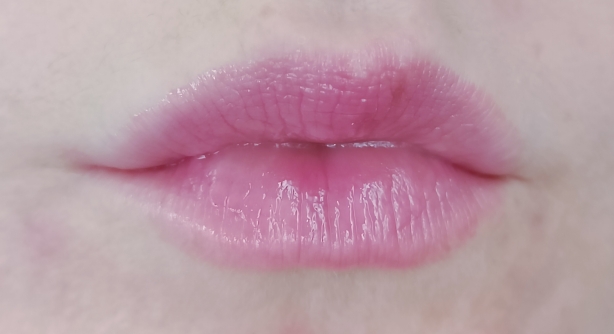 Tragebild Rose Bite